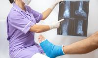 Photo of a broken leg a doctor holding an x-ray