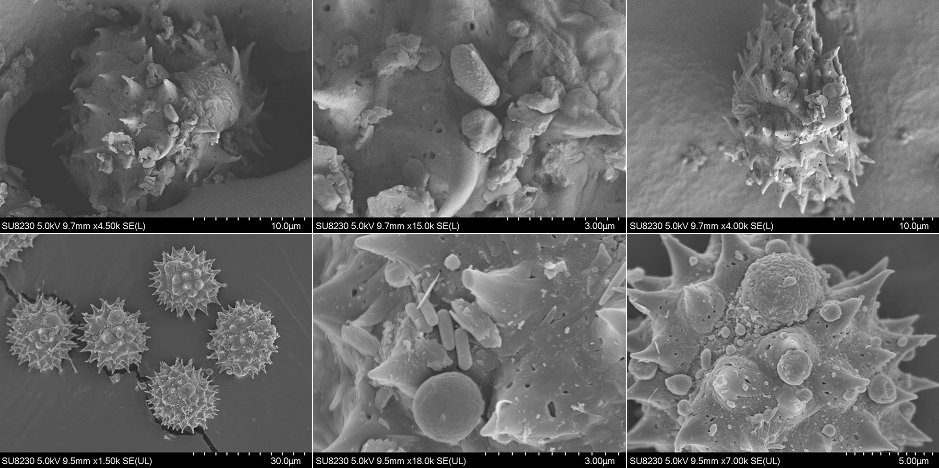 Photo of the honey (centrifuge-extracted and preserved) from the microscope